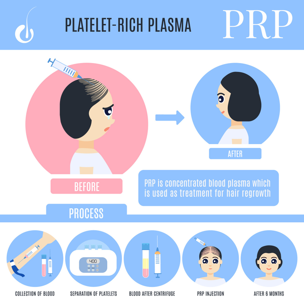 prp3